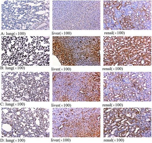 Figure 4 TUNEL staining results of lung, liver and renal tissue in different groups. (A–D) were the results of control group, HS(Tc) group, HS(Tc-1°C) group and HS(Tc+1°C) group, respectively.