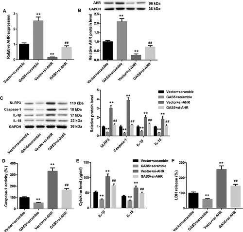 Figure 6. GAS5 overexpression inhibits NLRP3 inflammasome activation-mediated pyroptosis by regulating miR-34b-3p/AHR axis