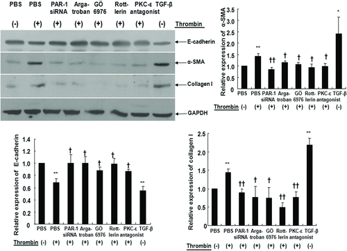 FIGURE 5  Expression of E-cadherin, α-SMA, and collagen I in cultured A549 cells was assessed with Western blot. Cells were either treated with 2 U/mL thrombin for 72 hours with or without pretreatment with 60 mM PAR-1 siRNA or 1 μM argatroban or 10 nM GÖ6976 or 4 μM rottlerin or 10 μM PKCε antagonist peptide for 30 minutes. Cells were also treated with 10 ng/mL TGF-β for 72 hours for positive control. Cell lysates were prepared, and then immunoblotted with antibodies for E-cadherin, α-SMA, and collagen I. Thrombin significantly increased α-SMA and collagen I expression and decreased E-cadherin expression. PAR-1 siRNA transfection, pretreatment with argatroban, GÖ6976, rottlerin or PKCε antagonist peptide inhibited epithelial-to-mesenchymal transition by thrombin. Data are means ± SE; n = 5/group. *, † P < .05; **, †† P < .01. **; compared with control. †, ††; compared with thrombin.