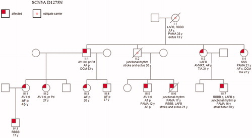 Figure 1. Pedigree indicating the ECG findings. Four of nine children of the oldest obligate mutation carrier (patient I:1) had the SCN5A mutation, only these individuals significant to genetic analysis and their children are included. AF: atrial fibrillation or flutter; AT: atrial tachycardia; AV I: grade I atrioventricular block; AVNRT: atrioventricular nodal re-entry tachycardia; c: chronic; DCM: dilated cardiomyopathy; LAFB: left anterior fascicular block; p: paroxysmal; PAMA: implanted pacemaker; pr Pd: prolonged P duration; RBBB: right bundle branch block; SSS: sick sinus syndrome; TIA: transient ischemic attack; y: years.