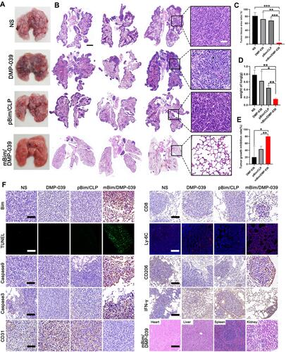 Figure 9 Therapeutic effect of the mBim/DMP-039 complex on the C26 pulmonary metastases model upon systemic administration. (A) Representative lung tissues harvested from each group. (B) H&E analysis of lung tissues using a whole lung view (scale bars: 2 mm) and partially enlarged view (scale bars: 50 μm). (C) Average tumor mass area rate for each group (**P < 0.01, ***P < 0.001). (D) Average weight of lungs (*P < 0.05, **P < 0.01). (E) Tumor growth inhibition rate for each group (*P < 0.05, **P < 0.01). (F) Immunohistochemical evaluation of tumor tissues from each group and H&E analysis of the main organ tissues from the mBim/DMP-039 complex group (scale bars: 50 μm).