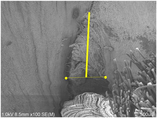 Figure 2. Gap measuring. The length of the line connecting the top of the crevice and the centre of the line drawn between the two ends of the base of the muscle crevice (thick yellow line) was measured.