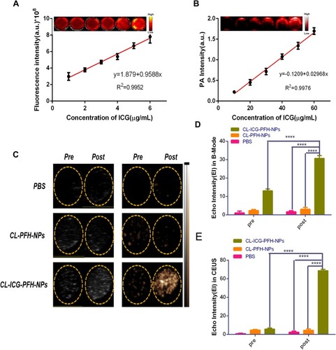 Figure 5 In vitro FL, PA and US imaging. (A) FL intensities and FL images of CL-ICG-PFH-NPs with different concentrations of ICG (n=3). (B) PA signals and PA images of CL-ICG-PFH-NPs with different concentrations of ICG (n=3). (C) Ultrasound images of CL-ICG-PFH-NPs before and after laser irradiation in vitro. (D) EI in B-mode and (E) EI in CEUS imaging before and after irradiation in different groups (n=3). There was a significant increase in the B-mode imaging and CEUS imaging effects in the CL-ICG-PFH-NP group when compared with the other two groups after irradiation (****P<0.0001). The difference was also detected in the CL-ICG-PFH-NP group before and after irradiation (****P<0.0001).Abbreviations: ICG, indocyanine green; PFH, perfluorohexanes; FL, fluorescence; PA, photoacoustic; US, ultrasound; EI, echo intensity; B-mode, brightness modulation; CEUS, contrast-enhanced ultrasound.