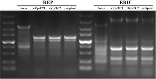 Figure 3. Agarose gel electrophoresis showed REP-PCR products with expected images. REP-PCR profile of the hvKp, cKp-TC1, cKp-TC2 and cKp strains used in this study. The primers used to perform repetitive extragenic palindromic PCR (REP-PCR) are REP (left) and ERIC (right), respectively.