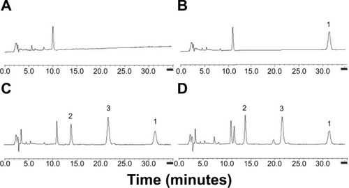 Figure 4 Specificity of MDZ, 1′-OH-MDZ, and diazepam determined by high-performance liquid chromatography method.