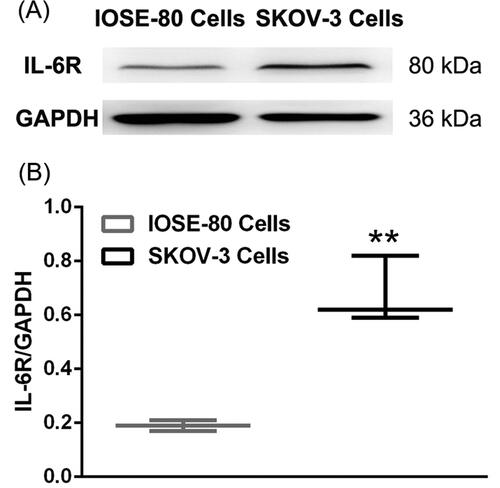 Figure 4. The results of western blot assay. (A) Protein expression level of IL-6R in IOSE-80 cells and SKOV-3 cells. (B) Densitometric analysis of IL-6R levels normalized to GAPDH levels (n = 3). **p < 0.01.