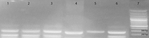Figure 1. 2% Agarose gel electrophoresis of PCR products. Lanes 1 and 2 represent 4G/5G genotype. Lanes 3 and 4 represent 4G/4G genotype. Lanes 5 and 6 represent 5G/5G genotype. Lane 7 is a molecular weight marker.