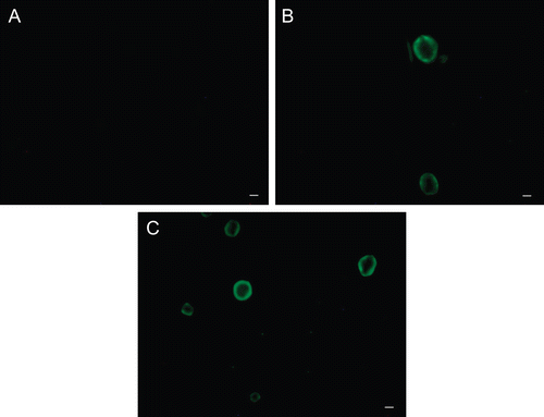 FIGURE 4  Fluorescence photomicrographs of rabbit corneal epithelial cells. (A) cells untreated; (B) and (C): cells incubated for 60 min with 2.5 and 5.0 mg/ml AG-FITC derivative, respectively. Scale bar, 10 μm.