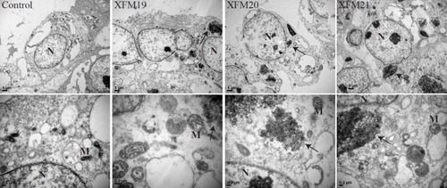 Figure 4 The ultrastructural changes of HUVECs. HUVECs were exposed to 64 μg/mL of pristine MWCNTs (XFM19), hydroxylated MWCNTs (XFM20) or carboxylated MWCNTs (XFM21). After 3 hrs exposure, TEM was used to image the ultrastructural changes of HUVECs and the internalized MWCNTs. The images in upper panel are images with low magnification, and the images in the lower panel are images with high magnification. The internalized MWCNTs were marked with arrows. Nuclei were marked with N and Mitochondria were marked with M.