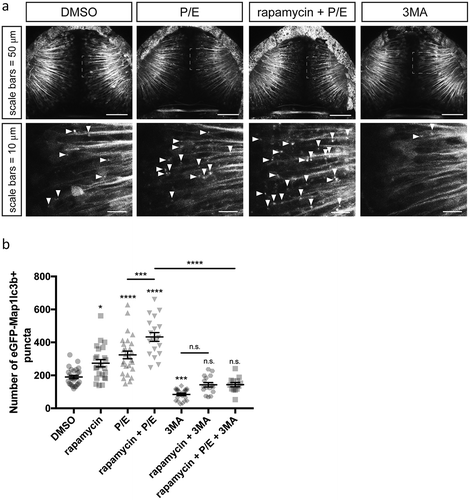 Figure 2. eGFP-Map1lc3b puncta are induced by rapamycin and P/E, and inhibited by 3-methyladenine treatment. (a) Representative maximum confocal projections of the optic tectum regions of 3-dpf larvae that underwent indicated treatment for 24 h. Arrowheads indicate examples of puncta. (b) Quantification of the numbers of eGFP-Map1lc3b-positive puncta in the optic tectum of 3-dpf larvae that underwent the indicated treatment for 24 h; mean ± s.e.m. shown; n ≥ 13 for each group. Results from BafA-treated groups are reported in Fig. S2.