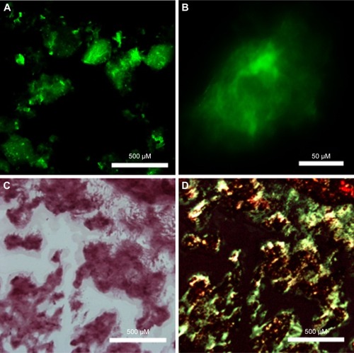Figure 5 Microscope images of RADA16-I nanofibers based on amyloid-like staining properties. Thioflavin-T-binding nanofibers could be observed by fluorescent microscope (A, B). Congo red-stained nanofibers were sorrel under normal light and (C) apple-green under polarized light (D).