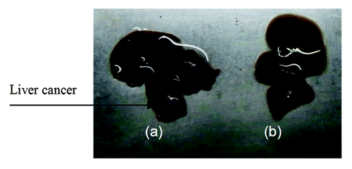 Figure 1. Establishment of the hepatic cancer mouse model. (A) Liver cancer; (B) normal mouse liver.