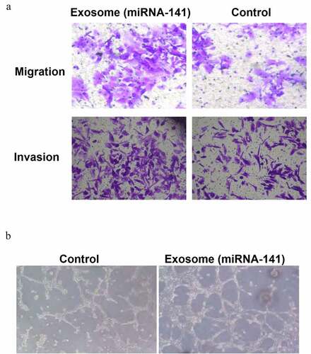 Figure 3. miRNA-141 promote the lung cancer cell metastasis and endothelial cells tubular structure formation