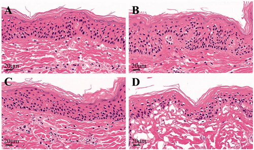 Figure 8. Histological photomicrographs of skins stained with HE after incubated with saline (A), IND/Gel (B), IND-Ts/Gel (C), and IND-HTs/Gel (D) (scale bar: 20 μm).