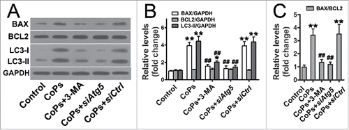 Figure 4. Autophagy mediated the upregulation of BAX induced by CoPs. (A) Western blots performed after osteoblast cells were incubated with 3-MA (10 mM), siAtg5 and siCtrl before being stimulated with CoPs (50 µg/ml) for 24 h. (B, C) The density of the western blots bands shown in (A) was quantified using ImageJ software. siCtrl, siControl. Data are presented as means ± S.E.M. from 3 independent experiments. *, P < 0.05 and **, P < 0.01 vs. control; ##, P < 0.01 vs. CoPs group.