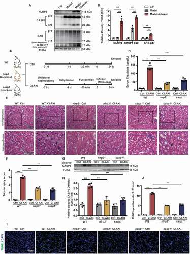 Figure 1. NLRP3 or CASP1 deficiency alleviated iohexol-induced renal injury and apoptosis. Unilateral nephrectomy, dehydration, furosemide (10 mL/kg, tail vein) were used to establish mice model. CI-AKI mice were established by iohexol (10 mL/kg bodyweight; injected through the tail vein, Model+Iohexol), and negative control group was injected with the same volume of normal saline (Model). (A and B) Immunoblotting analysis and quantification of NLRP3, CASP1 p20, IL1B p17. (C) Diagrammatic representation of Ctrl and CI-AKI in different groups of mice: WT(C57BL/6), nlrp3 and casp1 knockout. (D) The renal function was evaluated by serum creatinine. (E and F) Representative histology and pathological tubular injury score in the renal cortex by H-E staining. The tubular injury was indicated by arrows. Scale bar: 50 μm. (G and H) Immunoblotting analysis and quantification of cleaved CASP3. (I and J) Apoptosis was also evaluated by TUNEL staining and quantification of TUNEL-positive cells. Scale bar: 50 μm. Data were presented as mean ± SEM. n = 3–5. *p < 0.05, **p < 0.01, ***p < 0.001