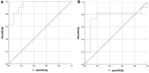 Figure 6 Receiver operating characteristic analysis for prediction of CKD stage based on hs-CRP. (A) CKD1 vs CKD2; (B) CKD2 vs CKD3.