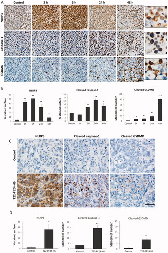 Figure 4. Activation of the pyroptotic pathway in CXCR4+ SW1417 cultured cells and in subcutaneous tumors after T22-PE24-H6 treatment. (A) Detection of pyroptotic markers, including NLRP3, cleaved caspase-1 and cleaved GSDMD, by ICC in cell blocks of CXCR4+ SW1417 cells exposed for 2, 5, 24 or 48 h to 6 nM of T22-PE24-H6. Stained sections were compared to untreated control CXCR4+ SW1417 cells. Scale bars: 50 µm. (B) Quantitation values of each marker staining in SW1417 control cells or in cells treated with T22-PE24-H6. In ICC of NLRP3 and caspase-1, up to 5 high-power fields (400x) were imaged and the percentage of stained surface was measured with ImageJ. In GSDMD staining, up to 5 high-power fields (400x) were analyzed by counting the number of GSDMD positive cells. (C) Representative images of IHC staining of NLRP3, cleaved caspase-1 and cleaved GSDMD in SW1417 SC tumors from Swiss nude mice treated with 10 µg of T22-PE24-H6, three times a week and 8 total doses. Scale bars: 50 µm. (D) Quantitation of pyroptotic markers in tumors from buffer-treated and T22-PE24-H6-treated mice. NLRP3 staining (5 high-power fields (400x) analyzed with ImageJ) was expressed as a percentage of the stained surface. To assess caspase-1 and GSDMD stained sections, we instead counted the number of positive cells in 5 high-power fields (400x). Measurements in tissue sections were performed 24 h after the last administered dose, being compared to buffer-treated control mice. All the data are expressed as mean ± s.e.m. * p < 0.05; ** p < 0.001.