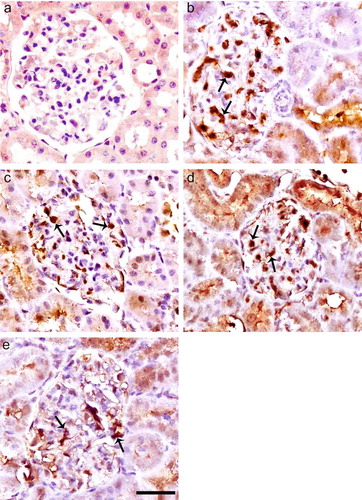 FIGURE 3. Immunoperoxidase staining of iNOS in glomeruli of control (a), diabetic untreated (b), diabetic treated with Irb (c), diabetic treated with ALA (d), and diabetic treated with Irb + ALA (e) rats. Immunohistochemical staining for iNOS is negative in glomerulus of control rats, but positive in the mesangium, podocytes, and capillary loop of untreated diabetic rats. The expression of iNOS in glomerules was lower in ALA and especially Irb-treated diabetic groups as compared with untreated diabetic rats. The expression of iNOS was much lower in ALA treatments in combination with Irb diabetic groups as compared with untreated diabetic group (arrows: positive immunostaining for iNOS, immunoperoxidase, hematoxylin counterstain; scale bar, 25 μm).