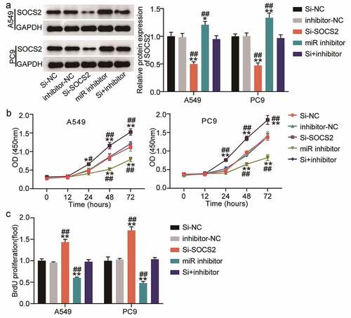 Figure 5. miR-3648 reverse the suppression effects of SOCS2 on LUAD cell malignancy phenotypes A. The expression of SOCS2 protein was detected by Western blot in A549 and PC9 cells after transfection with miR-3648 inhibitor, si-SOCS2, si-NC, inhibitor-NC and co-transfection with miR-3648 inhibitor and si-SOCS2. B. Cell viability was measured by CCK-8 assay in A549 and PC9 cells after transfection with miR-3648 inhibitor, si-SOCS2, si-NC, NC inhibitor and co-transfection with miR-3648 inhibitor and si-SOCS2. C. Cell proliferation was measured by BrdU incorporation assay in PC9 and A549 cells after transfection with miR-3648 inhibitor, si-SOCS2, si-NC, NC inhibitor and co-transfection with miR-3648 inhibitor and si-SOCS2. *P < 0.05, **P < 0.001 compared with si-NC group; #P < 0.05, ##P < 0.001 compared with si+inhibitor group, Student’s t-test.