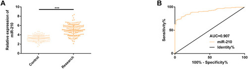 Figure 1 Expression of miR-210 in serum of colon carcinoma patients with hepatic metastasis. (A) miR-210 was up-regulated in serum of colon carcinoma patients with hepatic metastasis. (B) ROC curve of miR-210 in identifying hepatic metastasis of colon carcinoma.