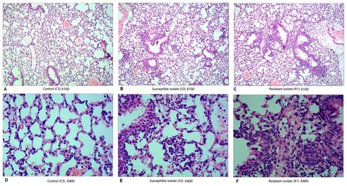 Figure 5. Histological changes in the haematoxylin and eosin-stained pulmonary tissue at 3 h post-infection (magnification: ×100 and ×400). Pulmonary inflammation in mice (n = 5–7 per group) challenged with phosphate-buffered saline (PBS), 108 colony-forming units (CFU) of Moraxella catarrhalis 73-OR, and 108 CFU of M. catarrhalis 35-OR. Representative lung tissue sections are shown. Pulmonary sections of control (C3) (magnification: ×100 (A) and ×400 (D)), mice (S3) challenged with 108 CFU of M. catarrhalis 73-OR (susceptible isolate) (magnification: ×100 (B) and ×400 (E)), and mice (R1) challenged with 108 CFU of M. catarrhalis 35-OR (resistant isolate) at 3 h post-infection (magnification: ×100 (C) and ×400 (F)).