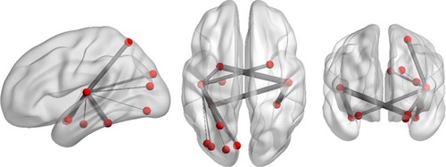 Figure 2 Three-dimensioned views by BrainNet Viewer; respectively, sagittal, axial, and coronal views, showing the same nodes as in Figure 1.