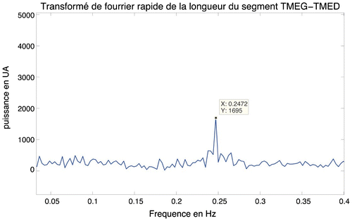 Figure 2 The highest amplitude of frequency around 0.25 Hz was defined during Fast Fourier transform of human breathing after computational process of length between TMEG and TMED