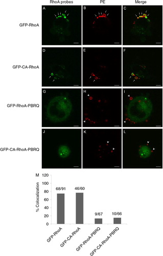 Fig. 3.  Colocalisation of RhoA probes in MPs. A–C, an intense presence of GFP-RhoA in PE-positive MPs (arrows). D–F, colocalisation of constitutively active GFP-RhoA in PE-positive MPs (arrows). G–I, substitution of cationic residues in the PBR of GFP-RhoA with Gln (PBRQ) abolished MP localisation and resulted in a mismatch with MPs (arrow heads). J–L, the PBRQ mutant of GFP-CA-RhoA has poor colocalisation in MPs. Scale bars represent 5 µm. M, a summary for rates of colocalisation between surface PE and RhoA derivatives.