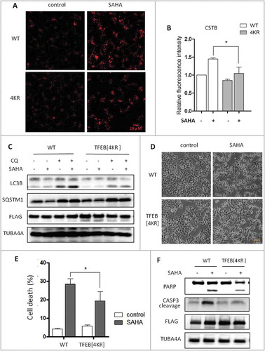 Figure 7. TFEB acetylation is involved in lysosomal activation and autophagy in SAHA-treated cells. (A) HCT116 cells were first transfected with WT TFEB or TFEB[4KR] and then treated with SAHA (1 μM) for 12 h. Cells were then stained with LysoTracker Red DND-99 (50 nM) for 15 min. Fluorescence intensity of treated cells was measured by confocal microscopy. Scale bar: 10 µm. (B) As in (A), cells were loaded with Magic Red CTSB reagent for 15 min and measured by flow cytometry. Data are presented as mean ± SD from 3 independent experiments. Statistical significance is indicated in the bar chart (* P < 0.05). (C) As in (A), HCT116 cells were treated with SAHA in the presence of CQ (25 μM) and then cells were lysed for detection of LC3B and SQSTM1 using immunoblotting. TUBA4A was used as loading control. (D) HCT116 cells were first transfected with WT TFEB or the TFEB[4KR] mutant and then treated with SAHA (2 μM) for 24 h. Cell death was quantified using propidium iodide (PI) live exclusion staining. Statistical significance is indicated in the bar chart (*P < 0.05). (E) As in (D), HCT116 cells were treated with SAHA (2 μM) for 24 h and then cells were harvested detection of CASP3 and PARP by immunoblotting.