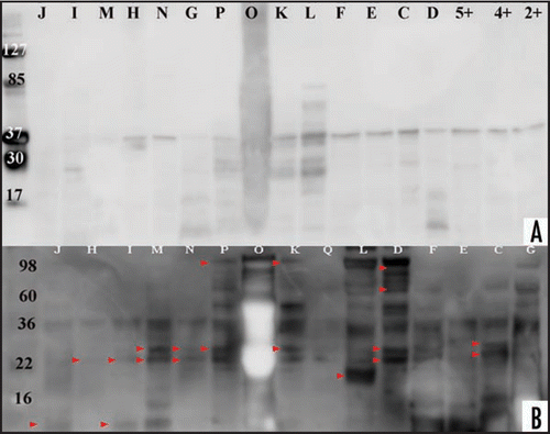 Figure 4 Western blot analysis of CJD, disease and healthy control urines. Proteinase K treatment of enriched urine samples and comparison between anti-IgG-HRP and anti-PrP-HRP probed membranes. Samples ID correspond to Table 1. Healthy control samples are shown with numbers (Proteinase K treated healthy control samples are designated with +). (A) Proteolytic treatment of urine samples from CJD, disease control and healthy control with proteinase K (concentration 60 µg/ml for 30 min). Protein transferred with Bio-Rad instrument and membrane probed with SAF61-HRP followed with ECL Plus addition. Membrane documentation was with Kodak Imager with 5 minutes exposure time. (B) This figure is a display of Figure 2A, highlighting majority of additional bands detected only with anti-PrP antibody, shown with arrows when the figure is compared to Figure 1A. The arrows point to bands detected only when SAF61-HRP was applied, the rest of the bands were detected with anti-IgG-HRP.