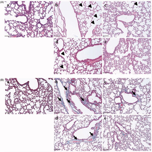 Figure 3. Socheongryongtang prevented the LPS-induced morphological changes in the pulmonary system. (A) In H&E staining, socheongryongtang suppressed the morphological changes related to COPD, such as inflammatory cell infiltration near the small airway and airway wall destruction (emphysema). (B) In Masson’s trichrome staining, socheongryongtang decreased the fibrogenicity near the bronchoalveolar area. N = 6. Scale bar: 100 µm. (a) Control; (b) 0.8 mg/kg LPS intranasal instillation; (c) 1 mg/kg Spiriva treatment for five days after LPS instillation; (d) 150 mg/kg socheongryongtang treatment for five days after LPS instillation; (e) 1500 mg/kg socheongryongtang treatment for five days after LPS instillation. Arrow head, emphysema; arrow, fibrosis. Magnification, ×200.