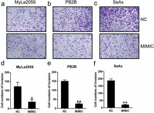 Figure 3. miR-337 overexpression suppressed the invasion of malignant T cells. After miR-337 plasmid transfection, the invasion capacity of MyLa2059, PB2B, and SeAx cells was measured using a transwell migration assay (a, b, c) and the number of invasive cells was counted (d, e, f). Representative data are expressed as mean ± SD. *P < 0.05, **P < 0.01. n = 3.