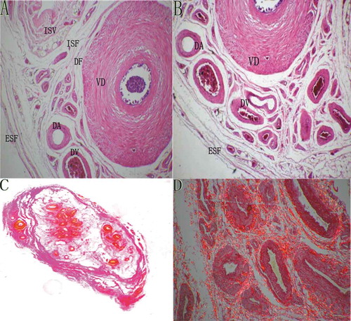Figure 1. Histologic transverse sections showing micro-structures of the sperm cord under a low-magnification microscope. VD: vas deferens, ESF: external spermatic fascia, ISF: internal spermatic fascia, ISV: internal spermatic vessels, DF:deferens fascia, DA: deferens artery, DV: deferens vein. (A & B) The sperm cord under a light microscope (HE staining, ×4). (C) The sperm cord under a stereo microscope (sirius red staining, ×2). (D) The morphology of fascia under a polarimicroscope (sirius red staining, ×4). The light red color shows the dense type II collagen of the fascia which is characterized by strong refractivity.