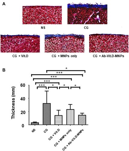 Figure 4 Ab-Vit.D-MNPs have the same therapeutic effect as vitamin D3 in ameliorating peritoneal fibrosis in a peritoneal dialysis (PD) mouse model. (A and B) Peritoneal fibrosis in the chlorhexidine gluconate (CG)-exposed group was significantly more severe than that in the saline group. Vitamin D3 significantly ameliorated peritoneal fibrosis, as visualized by Masson’s trichrome staining. Ab-Vit.D-MNPs have the same therapeutic effect on peritoneal fibrosis as vitamin D (Data are represented as the mean ± SD, n ≥ 3; *P < 0.05, ***P < 0.001).