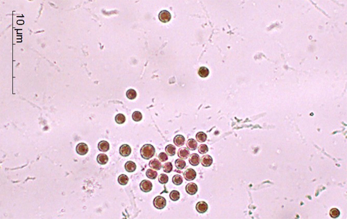 Figure 1. Microscopic observation (at 40× magnification) of Porphyridium sp. isolated from the Tunisian coast.