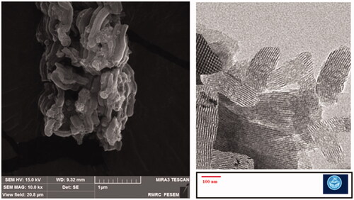 Figure 2. SEM and TEM images for the prepared MSNs.