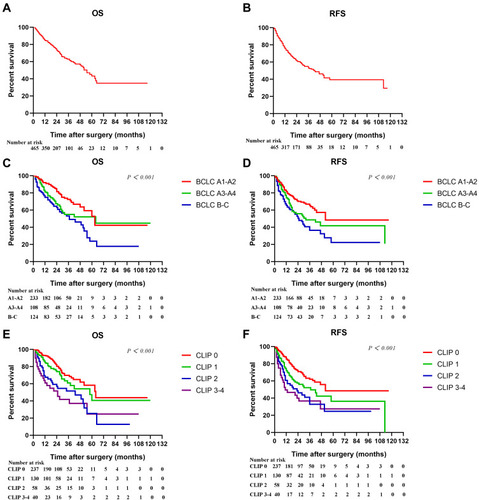 Figure 1 Kaplan–Meier cumulative overall survival (A) and recurrence-free survival (B) curves of the study population, and overall survival and recurrence-free survival curves of patients stratified according to BCLC (C–D) and CLIP (E–F) staging systems.