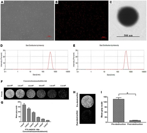 Figure 3 Basic characteristics of the nanobubbles. (A) Observation of PTX-AMD070 NBs under a light microscope. (B) Observation of DiI-labeled PTX-AMD070 NBs under a fluorescence microscope. (C) Observation of PTX-AMD070 NBs under a transmission electron microscope. (D) Spectrum of PTX NB particle sizes. (E) Spectrum of PTX-AMD070 NB particle sizes. (F) An ultrasound image of PTX-AMD070 NBs in vitro. (G) Quantitative analysis of imaging intensity of PTX-AMD070 NBs in vitro. (H) Ultrasound images of PTX-AMD070 NBs in vitro before and after ultrasonic blast. (I) Quantitative analysis of imaging intensity of PTX-AMD070 NBs before and after ultrasonic blast (*P<0.05).