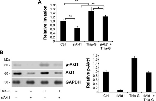 Figure 7 Akt1 silencing disrupts the promotion of O-GlcNAcylation on invasion of thyroid anaplastic cancer cells.