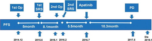 Figure 3. Treatment timeline (Op: operation; SRS: stereotactic radiosurgery).