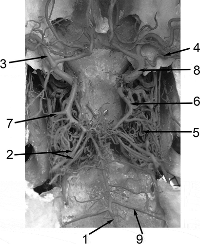 Figure 1. Dorsal view of the arterial circle of the brain and its connections and branches of the Bactrian camel (Camelus bactrianus). 1: A. basilaris; 2: Aa. cerebelli rostrales; 3: A. cerebri media; 4: A. choroidea rostralis; 5: Rete mirabile epidurale rostrale; 6: A. communicans caudalis; 7: A. cerebri caudalis; 8. A. cerebri rostralis; 9. A. cerebelli caudalis.