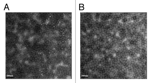 Figure 5. Transmission electron micrograph of HPV16 and HPV18 L1 VLP ( × 25,000, Bar = 200 nm). (A). HPV16 L1 VLP; (B). HPV18 L1 VLP.