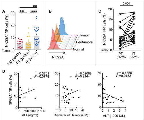 Figure 1. The frequency of intratumor NKG2A+ NK cells is increased in HCC. (A, B) The percentage of NKG2A-expressing NK cells in healthy livers (N = 17) and IT (N = 28) and PT (N = 25) from HCC patients. The differences in the cumulative data were calculated using a Kruskal–Wallis ANOVA followed by Dunn's multiple comparisons test. (C) NKG2A expression in NK cells from the paired IT and PT from each HCC patient (N = 23, Wilcoxon non-parametric statistical test). (D) The correlation between NKG2A expression in hepatic NK cells from IT and the serum AFP and ALT levels and tumor diameters of HCC patients. Spearman's correlation coefficients are shown.