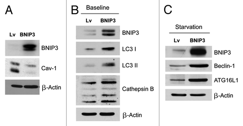 Figure 1. Fibroblasts overexpressing BNIP3 show a loss of Cav-1 expression, with constitutive activation of the autophagic program. BNIP3 was stably overexpressed in hTERT fibroblasts via transduction with lenti-viral vectors. Lv- represents fibroblasts transduced with the vector alone control, namely Lv-105 (puro). (A) Note that BNIP3 overexpression in fibroblasts is sufficient to cause a dramatic reduction in caveolin-1 (Cav-1) protein expression, seen by immunoblot analysis. (B) Similarly, BNIP3 overexpression drives the upregulation of LC3-I and -II and cathepsin B, under basal cell culture conditions.(C) Overnight starvation drives even stronger expression of BNIP3, as well as Beclin1 and ATG16L1, which are other key markers of autophagy. Thus, BNIP3 overexpression in fibroblasts is indeed sufficient to drive a loss of Cav-1 expression via the activation on an autophagic program. In all three panels, immunoblotting with β-actin is shown as a control for equal protein loading.