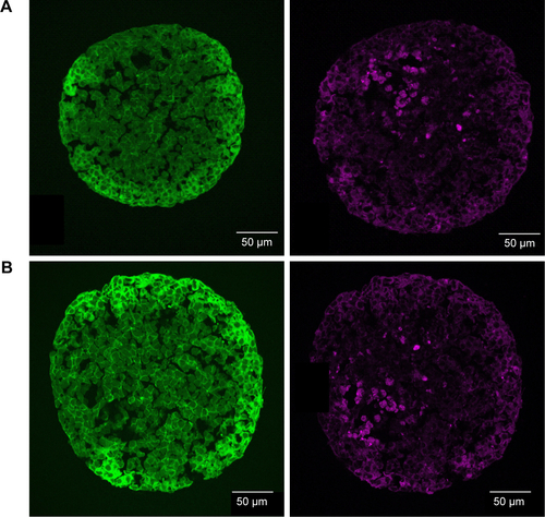 Figure S5 Localization of ATTO 647N-APTES dye conjugate in spheroids.Notes: HepG2 spheroids were exposed to 0.83 µM ATTO 647N-APTES dye conjugate after spheroid formation (A) or during spheroid formation at day 0 (B). In representative confocal fluorescence micrographs, the actin cytoskeleton (green, left) or ATTO 647N-APTES dye conjugate (magenta, right) are presented.