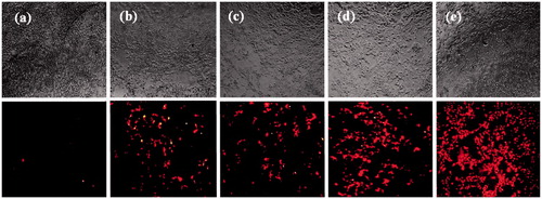 Figure 11. Representative fluorescent images of transfection efficiency in HEK293T cell line. Naked plasmid (a), DP transfection (b), DN transfection (c), DPN transfection (d) and DNN transfection (e) in HEK293T cells detected by red fluorescence protein (mCherry) using a fluorescence microscope at 48 h after transfection. Transfections were performed in 96-well plates using 1 µg of plasmid per well. DP: DNA/protamine; DN: DNA/NMM; DPN: DNA/protamine/noisome; DNN: DNA/NMM/niosome.