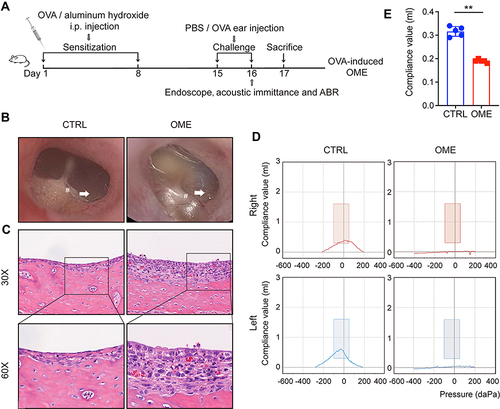 Figure 1 Evaluation of the OVA-induced OME rat model. (A) The scheme of the experimental OVA-stimulated OME establishment. The rats were sensitized with 1.2 mg ovalbumin on day 1 and day 8 and then challenged by intra-aural injection of OVA or PBS as a control. (B) The morphology of the tympanic membrane viewed through an endoscope showing the secretions (arrow) and the radial vascularity (pound sign). (C) The severity of the middle ear injury was evaluated by HE staining at 30× and 60× magnification. (D) The acoustic immittance confirmed the existence of OME in the OME rats. In the control group, both the right ear and left ear were type A or As, which meant that the control group had normal hearing and no otitis media in the ears. In the OME group both the right ear and left ear were type B, which meant that the rats had hearing loss and OME. (E) The statistical analysis of the acoustic immittance according to the compliance values. The error bars represent the s.e.m. of 5 rats per group. **P < 0.01.