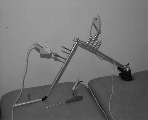 Figure 1. Leg model with rigid tracker mountings.