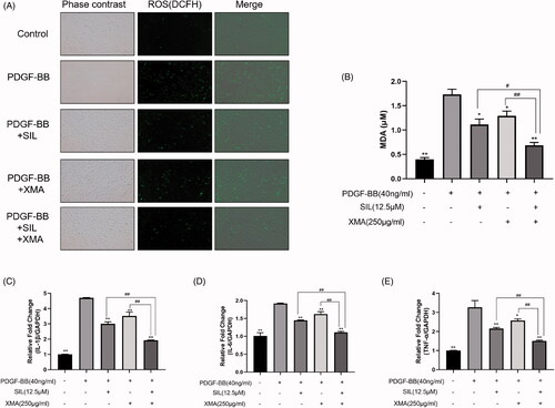 Figure 5. Effects of SIL and XMA administered separately or in combination on oxidative stress levels. (A) The level of ROS in PASMCs. (B) The level of MDA in PASMCs. (C) The level of IL-1β in PASMCs. (D)The level of IL-6 in PASMCs. (E) The level of TNF-α in PASMCs. Data are presented as the mean ± SEM. (n = 3). *p < 0.05, **p < 0.01 vs. PDGF-BB group; #p < 0.05, ##p < 0.01 vs. SIL + XMA group.